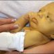 علت زردی در نوزادان | تاثیر تغذیه مادر برای زردی نوزاد چقدر است؟
